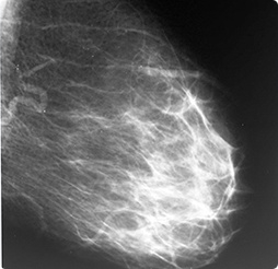 Маммограф МЭМ 20-08