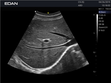 EDAN Acclarix LX25
