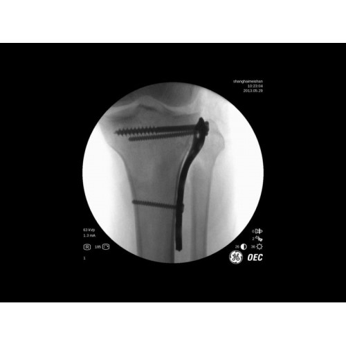 Моноблочный рентгенохирургический аппарат GE Brivo OEC 785/865