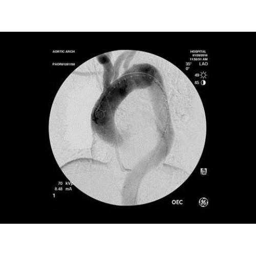 Рентген аппарат GE OEC 9900 Elite