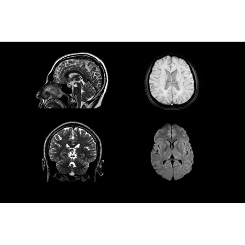 МРТ аппарат GE SIGNA Creator 1.5T