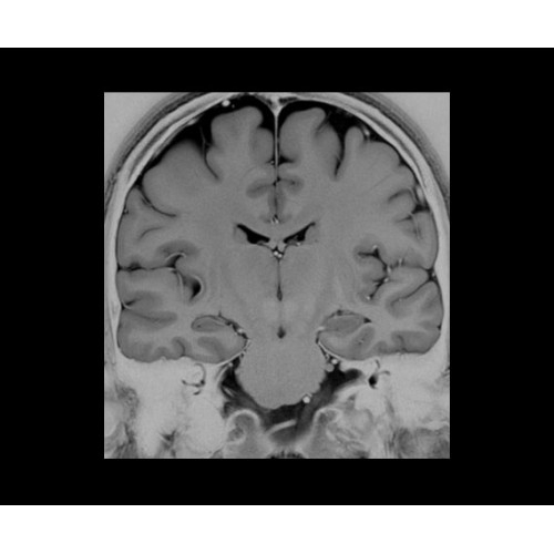 МРТ аппарат GE SIGNA PET/MR 3.0T