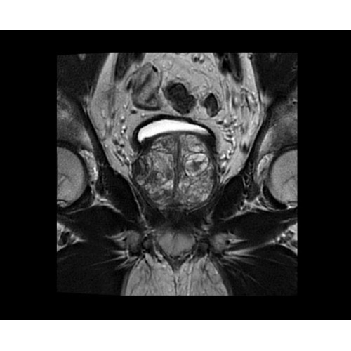 МРТ аппарат GE SIGNA PET/MR 3.0T