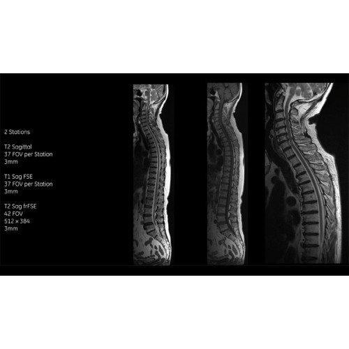 МРТ аппарат GE SIGNA Voyager 1.5T