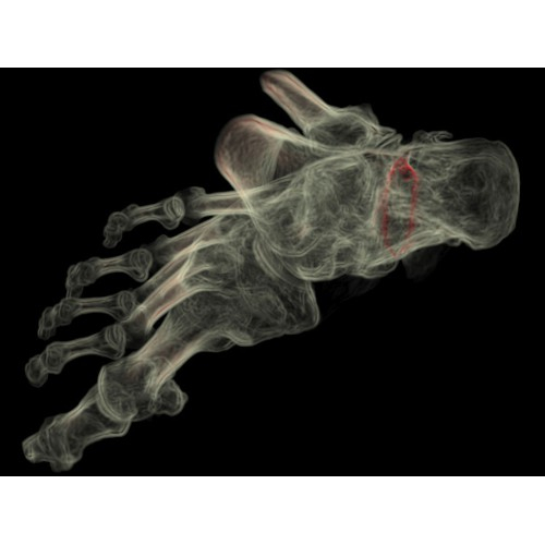 КТ аппарат GE Optima CT520