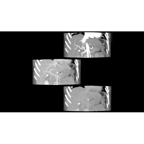 КТ аппарат GE Revolution CT