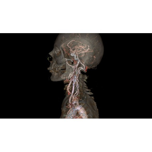 КТ аппарат GE Revolution CT